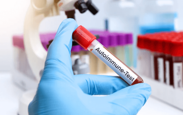 Autoimmune Testing